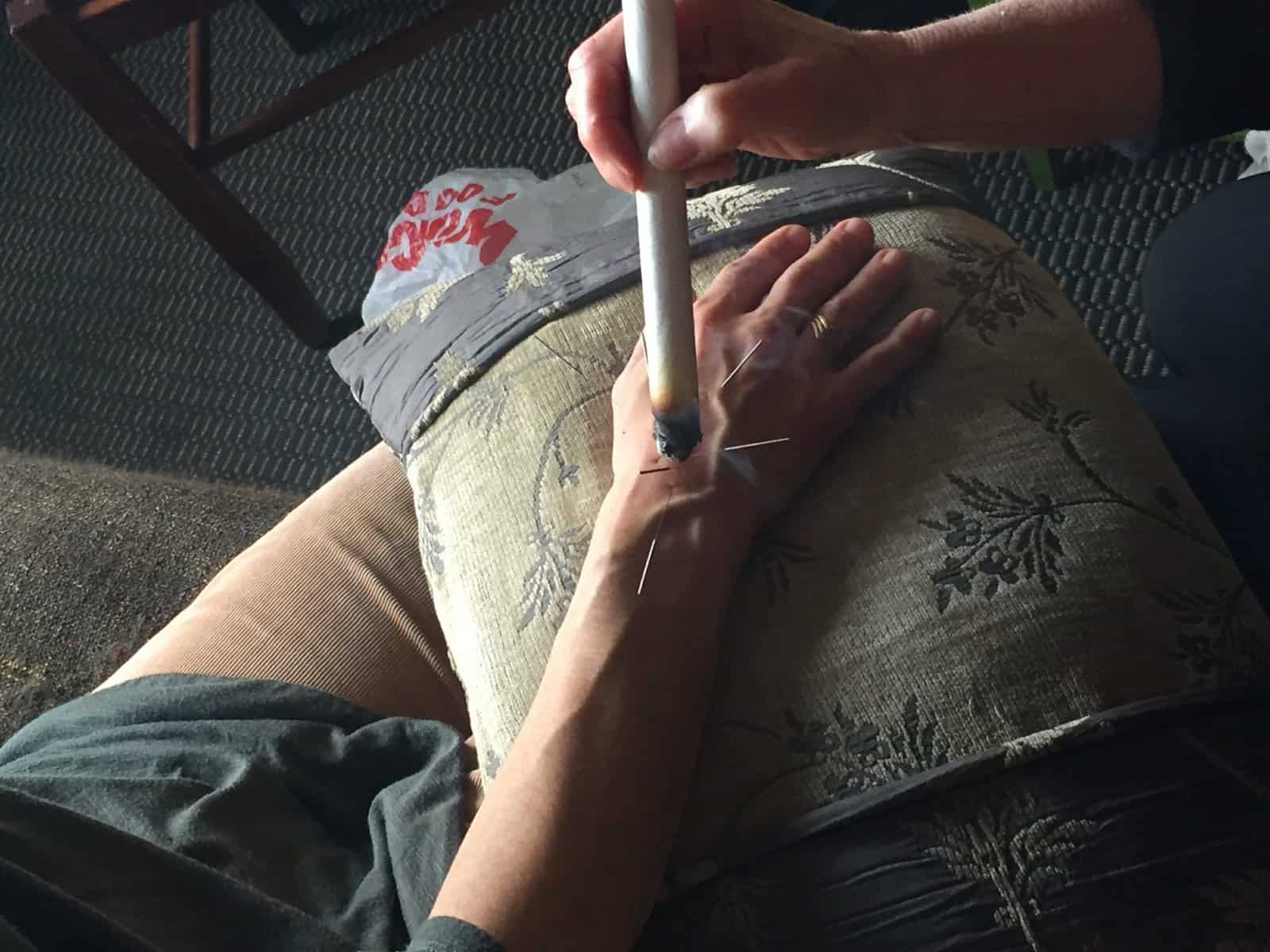 Portland acupuncture